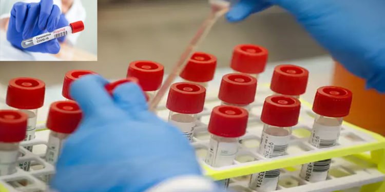 भारत ने तैयार कर ली कोरोना टेस्टिंग किट, ढाई घंटे में किये जा सकेंगे 90 सैंपल टेस्ट